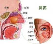 【全國(guó)愛(ài)鼻日】孩子出現(xiàn)這些癥狀，警惕鼻竇炎！ 