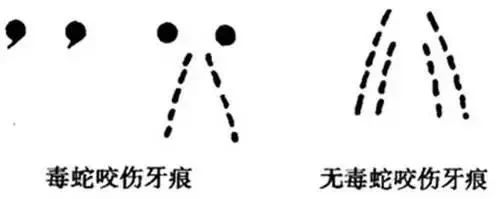 被蛇咬傷怎么辦？ 福德醫(yī)院教你毒蛇咬傷急救指南